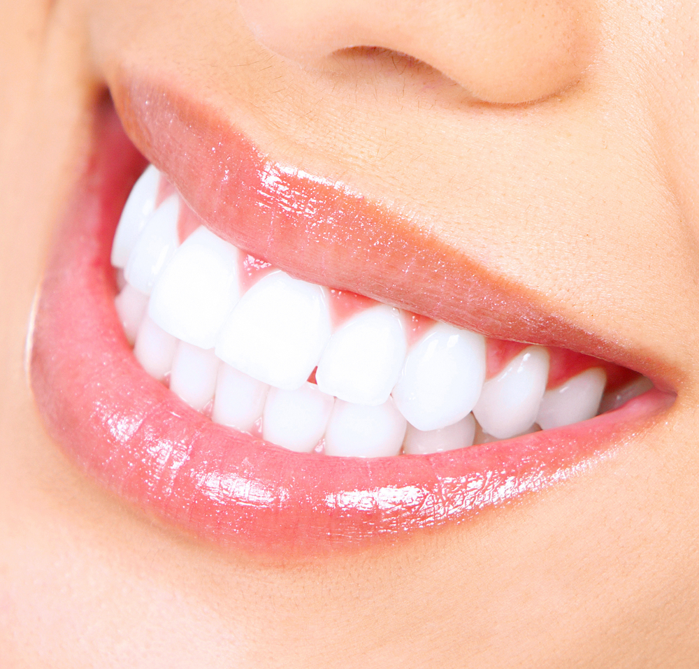 Teeth Whitening - Portland, OR - Healthy Smiles Dental Group
